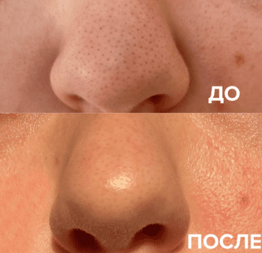 14751b083acbf12ea98751879fecb5e3.jpg