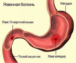 20e9622f192076f43ff8e276ef4abb93.jpg