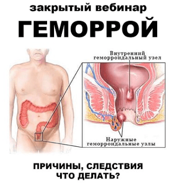dc89602e4187f558a73d512e60e12515.jpg