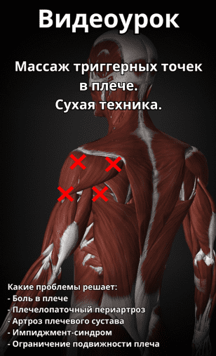 ef85d292d82caada25ca6855a9814ad2.jpg