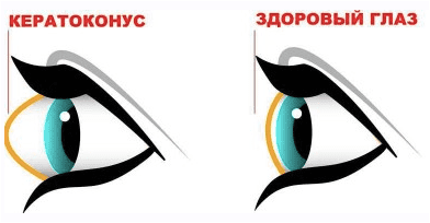 f5c2696403498de5c829d43057d831ab.jpg